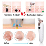 Face Blackheads Remover Tool – Pore Cleaner for Nose, Chin & Forehead